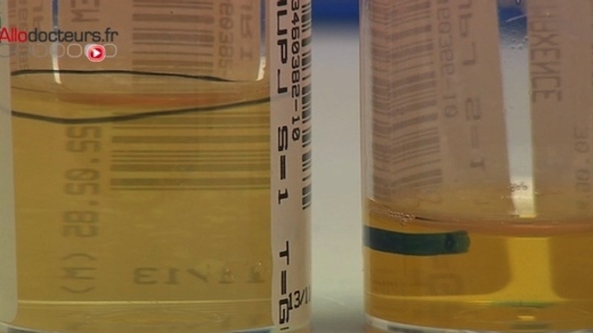 L'hepcidine aurait une action inhibitrice sur la croissance et la reproduction des bactéries (Image d'illustration)