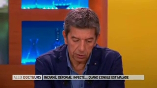 Mycose de l'ongle : quel traitement ?