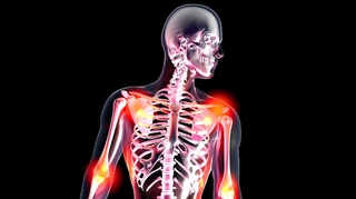 Fibromyalgie : les réponses à vos questions sur notre Facebook Live