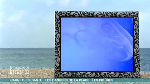 Il faut tout d’abord rincer la piqûre de méduse avec de l’eau de mer.