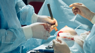 Chirurgie esthétique : quel recours après une opération mammaire ratée ? 