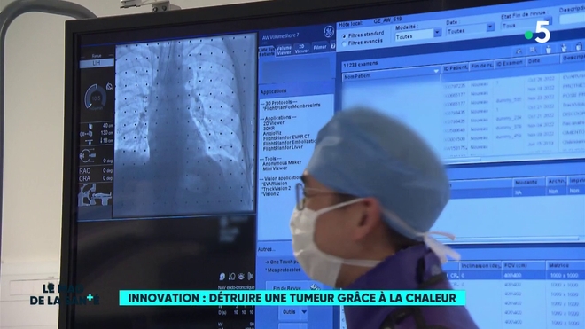 Reportage innovation détruire tumeur avec chaleur