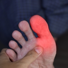 La goutte : une maladie en développement