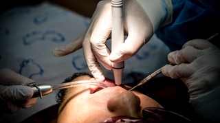 Pourquoi la Sécurité Sociale va-t-elle moins rembourser les soins dentaires ?