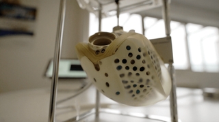 Comment fonctionne le cœur artificiel Carmat ?
