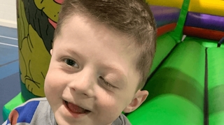 Un bébé survit à une tumeur au cerveau après 13 opérations