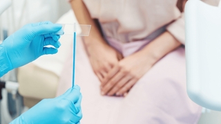 Âge, fréquence, auto-prélèvement : on vous dit tout sur les frottis et le test HPV