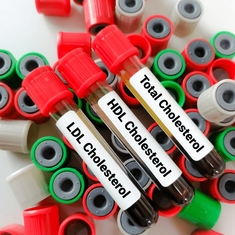 Cholestérol : le bon, le mauvais... et l'excès